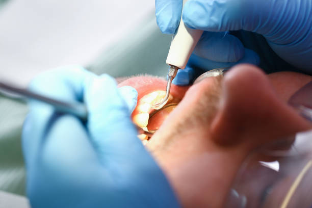 Best Weekend Emergency Dentist in Kent City, MI